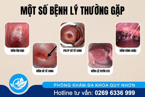 ra-khi-hu-co-phai-mang-thai-1