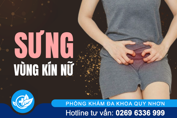 Sưng vùng kín nữ là do đâu?