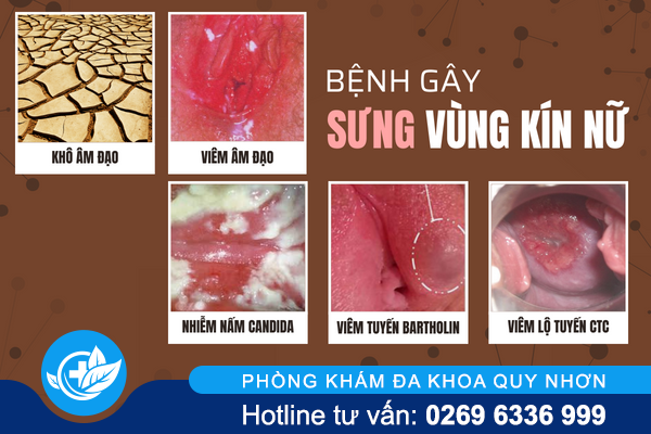 sung-vung-kin-nu-la-do-dau-1