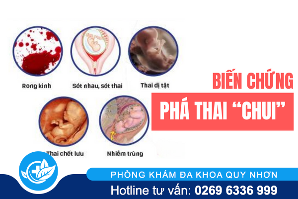 benh-vien-pha-thai-an-toan-kin-dao-va-ve-trong-ngay-01