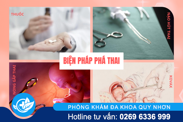 benh-vien-pha-thai-an-toan-kin-dao-va-ve-trong-ngay-03