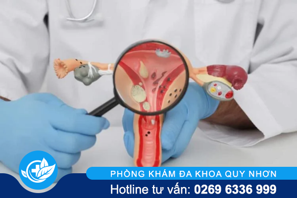 Chi phí khám phụ khoa ở bệnh viện