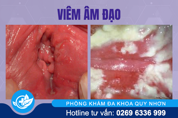 noi-man-ngua-vung-kin-la-do-dau-2