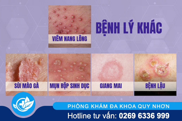 noi-man-ngua-vung-kin-la-do-dau-3