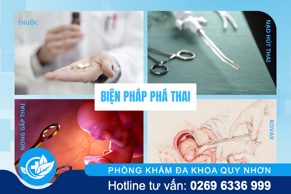 phong-kham-pha-thai-dang-tin-cay-bao-ve-suc-khoe-3