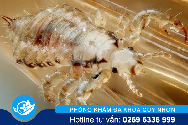 ran-mu-la-benh-gi-nguyen-nhan-dau-hieu-va-cach-chua-1