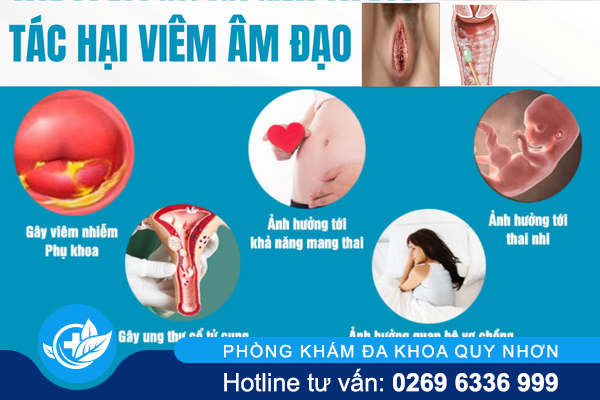 benh-phu-khoa-va-nhung-tac-hai-khong-ngo-1