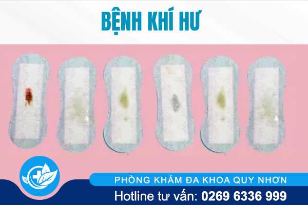 benh-phu-khoa-va-nhung-tac-hai-khong-ngo-2