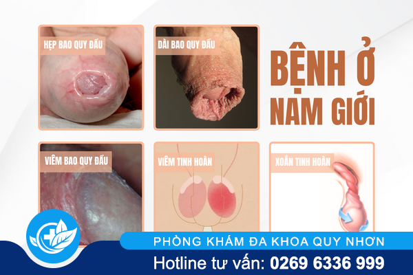 dau-rat-vung-kin-canh-bao-benh-gi-va-lam-sao-khac-phuc-1