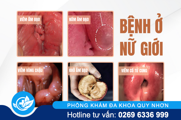 dau-rat-vung-kin-canh-bao-benh-gi-va-lam-sao-khac-phuc-2