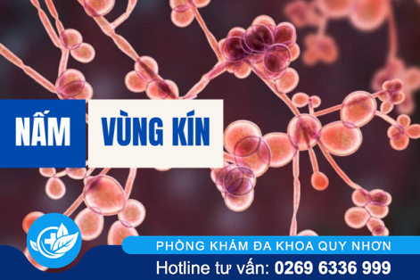 Nấm vùng kín là gì và khắc phục thế nào?