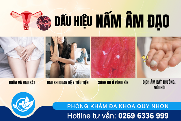 nguyen-nhan-gay-benh-nam-am-dao-2