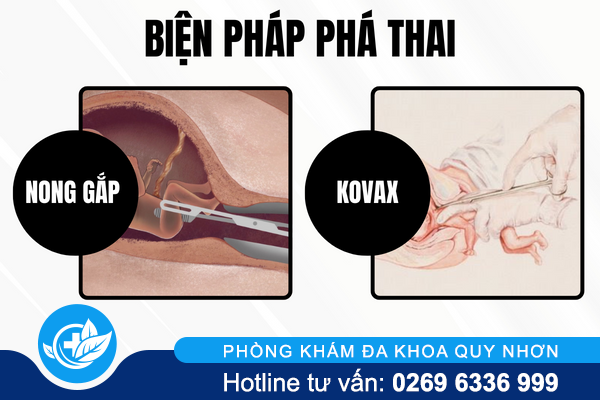 pha-thai-tren-18-tuan-co-duoc-khong-2