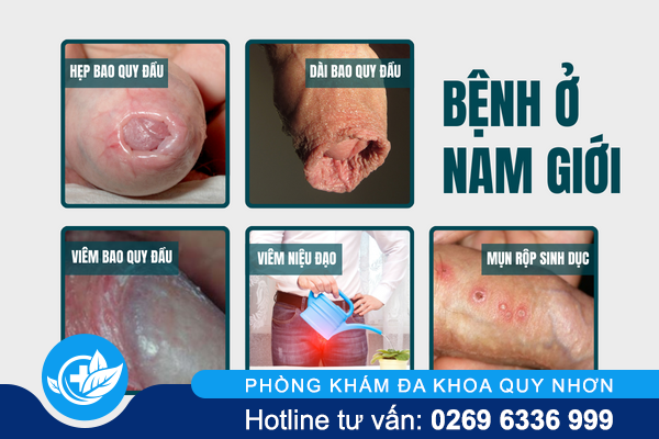 sung-vung-kin-benh-gi-va-khac-phuc-the-nao-hieu-qua-2