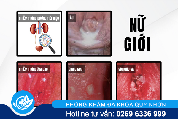 tieu-ra-mau-bao-dong-nguy-hiem-2