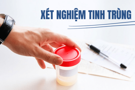Xét nghiệm tinh trùng – Những vấn đề liên quan