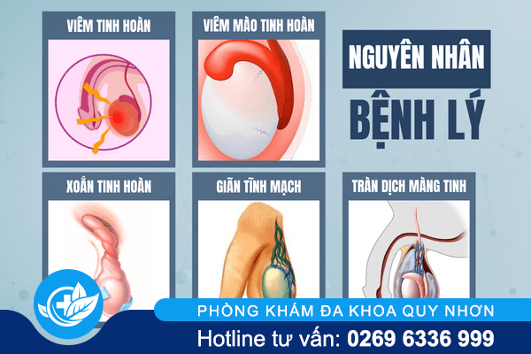 dau-tinh-hoan-nhung-khong-sung-la-do-dau-dieu-tri-the-nao-1