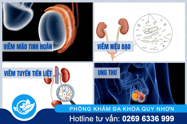 dau-tinh-hoan-quy-nhon-02