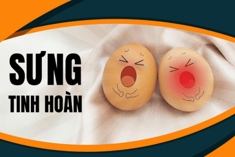 Sưng tinh hoàn – Cơ thể đang bật báo động đỏ.