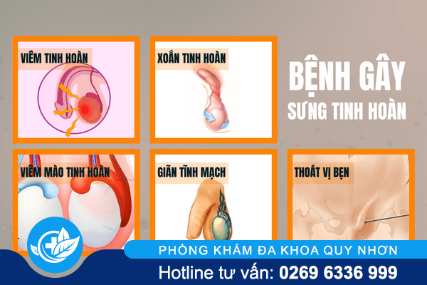 sung-tinh-hoan-co-the-dang-bat-bao-dong-do-1