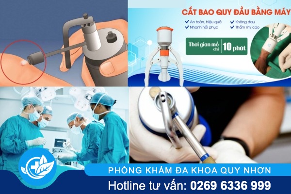 chua-chuoi-hat-ngoc-o-duong-vat-nam