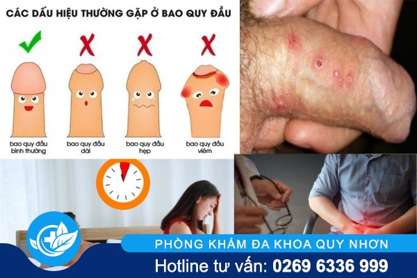 dau-hieu-benh-nam-khoa