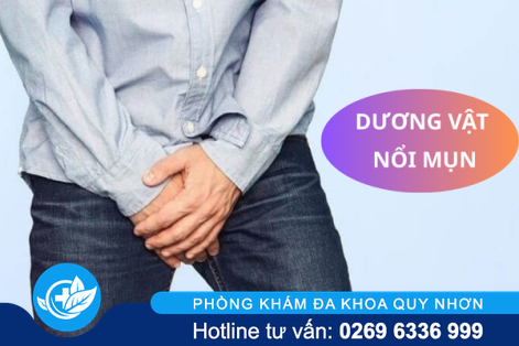 Dương vật nổi mụn – dấu hiệu cảnh báo bệnh nguy hiểm