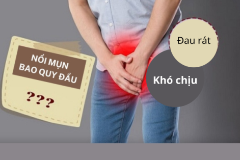 Bao quy đầu nổi mụn là bị bệnh gì có nguy hiểm không?