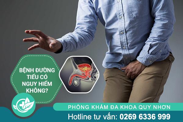 Tổng Hợp Các Bệnh Đường Tiểu Thường Gặp Hiện Nay