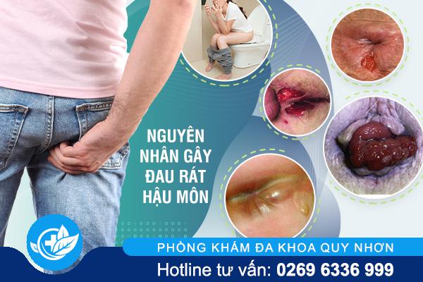 Đau Rát Hậu Môn Là Bệnh Gì?
