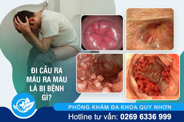 di-cau-ra-mau-la-dau-hieu-benh-gi-cach-dieu-tri-hieu-qua-01