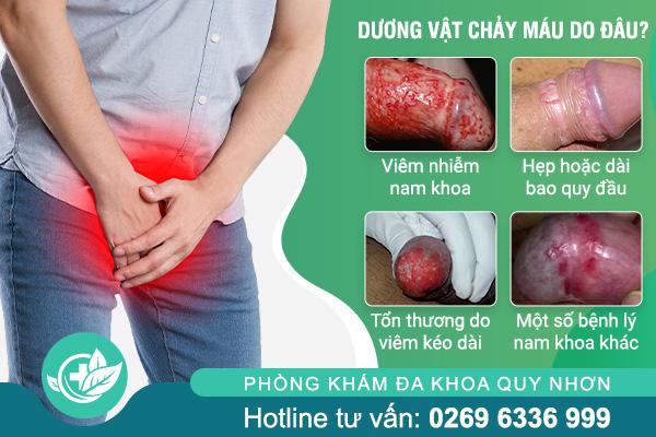 duong-vat-chay-mau-do-dau