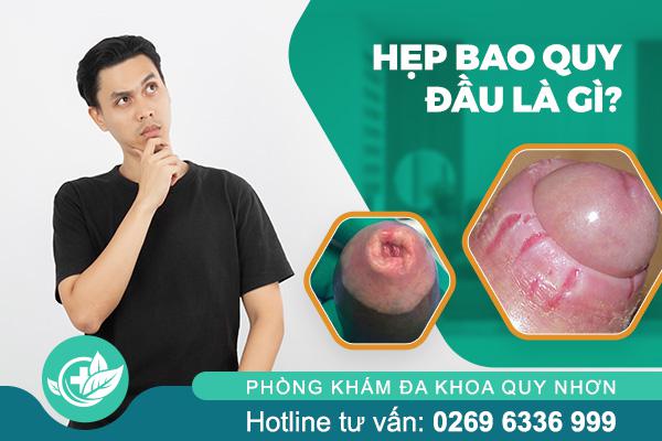 hep-bao-quy-dau-la-gi
