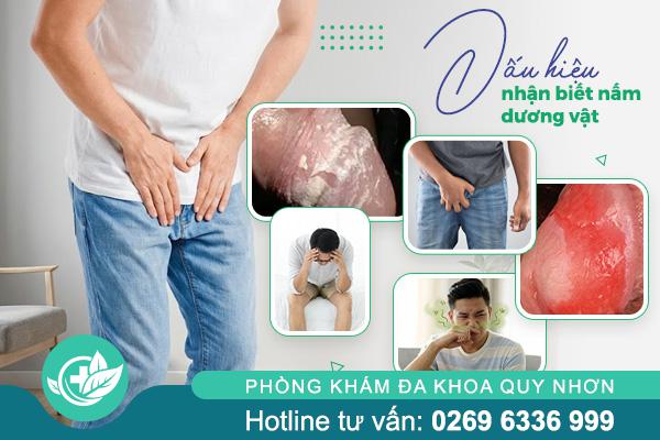 Nấm dương vật là gì? Dấu hiệu và cách nhận biết