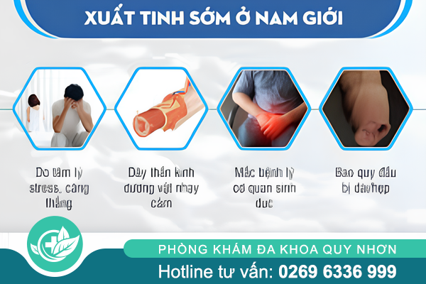 Nguyên nhân khiến nam giới quan hệ nhanh ra