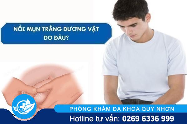 Dương Vật Nổi Mụn Trắng: Nguyên Nhân Và Cách Xử Lý