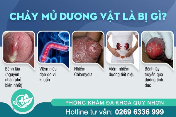 chay-mu-duong-vat-la-bi-gi