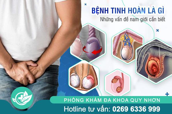 Bệnh tinh hoàn là gì? Những vấn đề nam giới cần biết