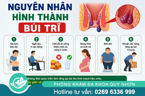Búi trĩ hình thành như thế nào? Những điều ai cũng nên biết