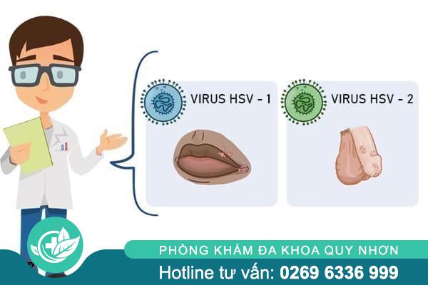 Mụn rộp sinh dục là gì? Những điều cần biết để bảo vệ sức khỏe