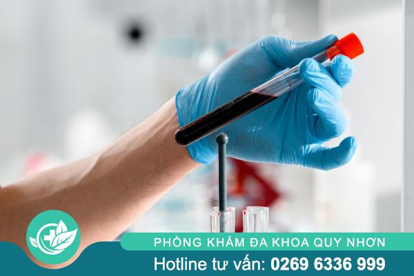 Xét Nghiệm Bệnh Xã Hội: Giải Pháp Chủ Động Bảo Vệ Sức Khỏe Sinh Sản