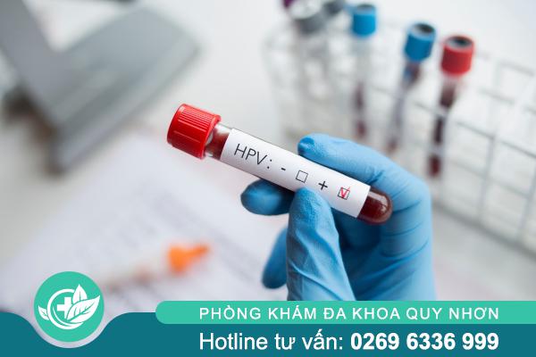 Xét nghiệm sùi mào gà sớm – Bước quan trọng phát hiện bệnh