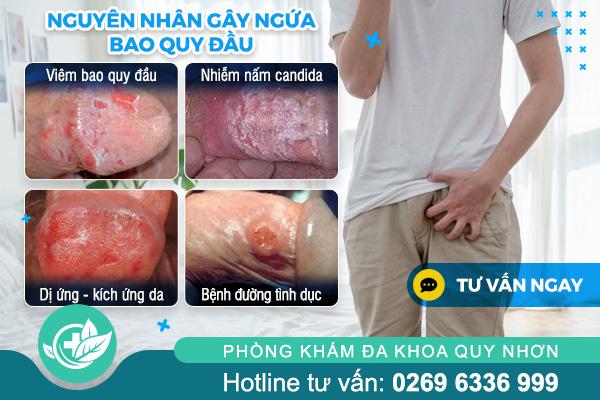 nguyen-nhan-gay-ngua-bao-quy-dau (1)