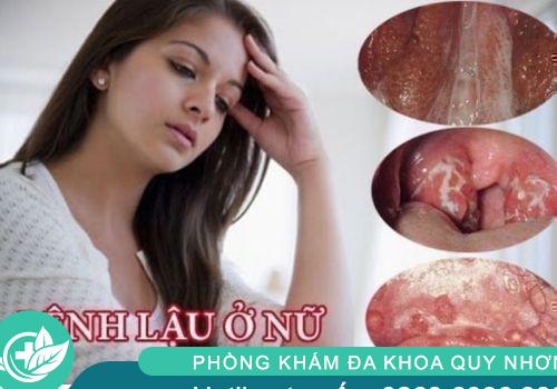 benh-lau-nu