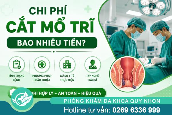 Chi phí cắt mổ trĩ bao nhiêu tiền?