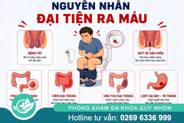 Đại Tiện Ra Máu: Dấu Hiệu Cảnh Báo Các Bệnh Hậu Môn – Trực Tràng