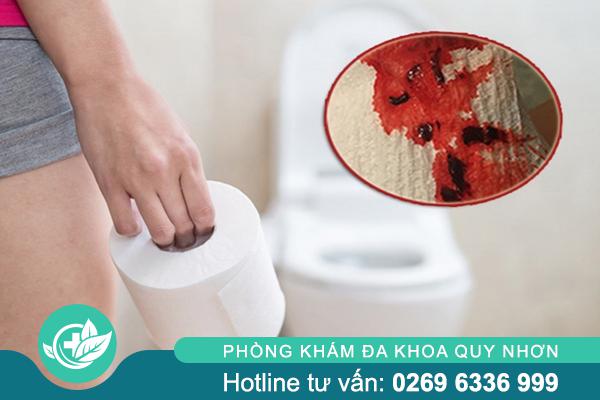 Đại Tiện Ra Máu: Dấu Hiệu Cảnh Báo Các Bệnh Hậu Môn – Trực Tràng