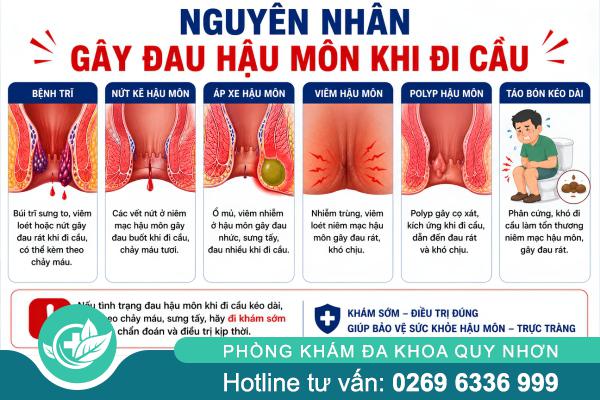 Đau Hậu Môn Khi Đi Cầu: Nguyên Nhân, Dấu Hiệu Và Cách Khắc Phục