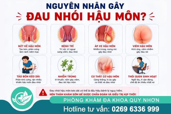 Đừng Bỏ Qua Cơn Đau Nhói Hậu Môn – Có Thể Là Dấu Hiệu Bệnh Nặng