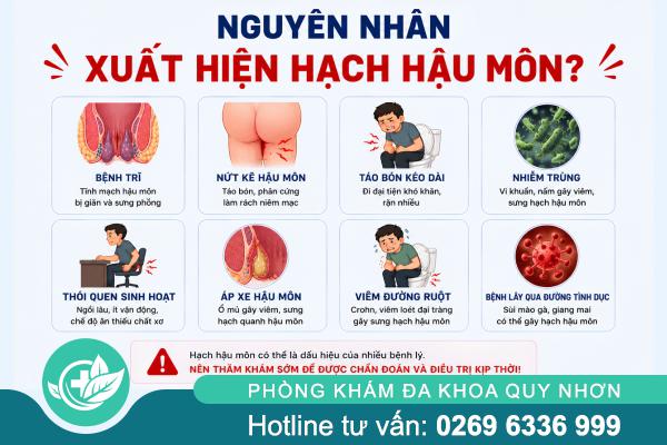 Hạch Hậu Môn Có Nguy Hiểm Không? Khi Nào Cần Đi Khám?